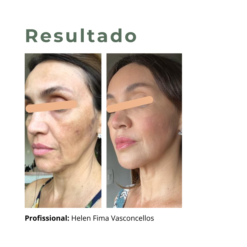 Sem nome 2000 x 2000 px 26