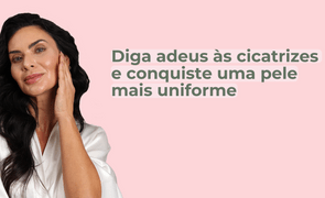 BANNER BLOG CERTO 3